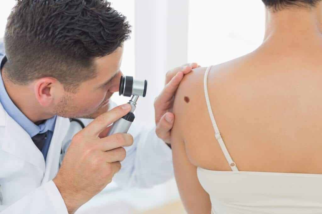 doctor checking a mole on a woman's shoulder